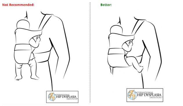 Correct positioning and safety Over the last few years, a lot of research has taken place to determine the correct positioning for a baby being carried in a sling, wrap or carrier. The most important considerations are the position of the legs, the spine and the head, especially if your baby is a newborn. The carrier must allow babies to assume a ‘frog leg’ sitting position, and the spine to have a natural curve. These are paramount to avoid hip dysplasia.