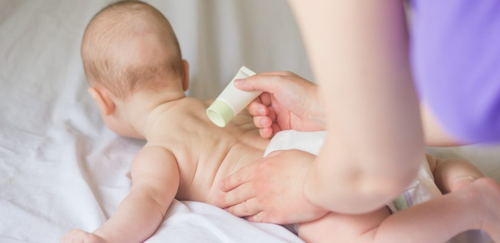 أفكار فعالة في علاج أكزيما الرضع